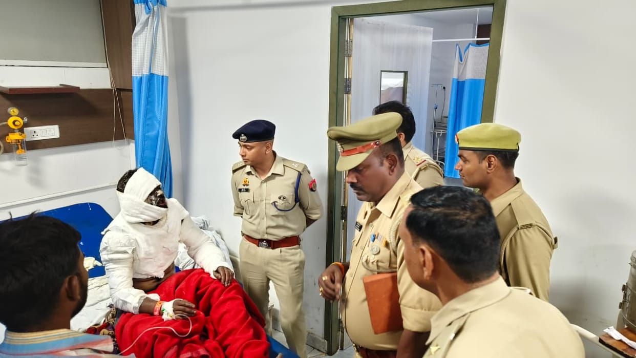 Muzaffarnagar: Youth Sets Himself on Fire After Assault, Referred to Higher Medical Center