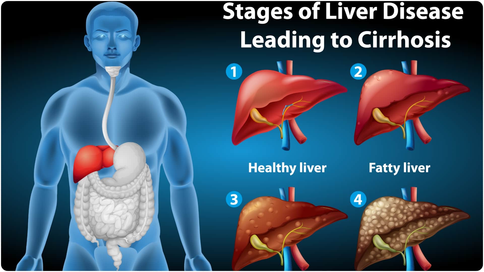 world liver day 2026 liver cirrhosis causes symptoms and risk factors in hindi