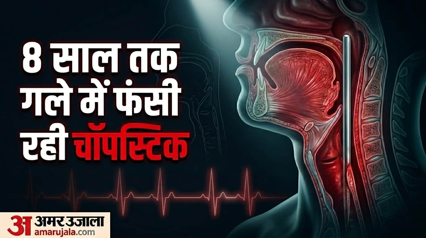 Bizarre Man survives for 8 years with 12cm metal chopstick stuck in his throat