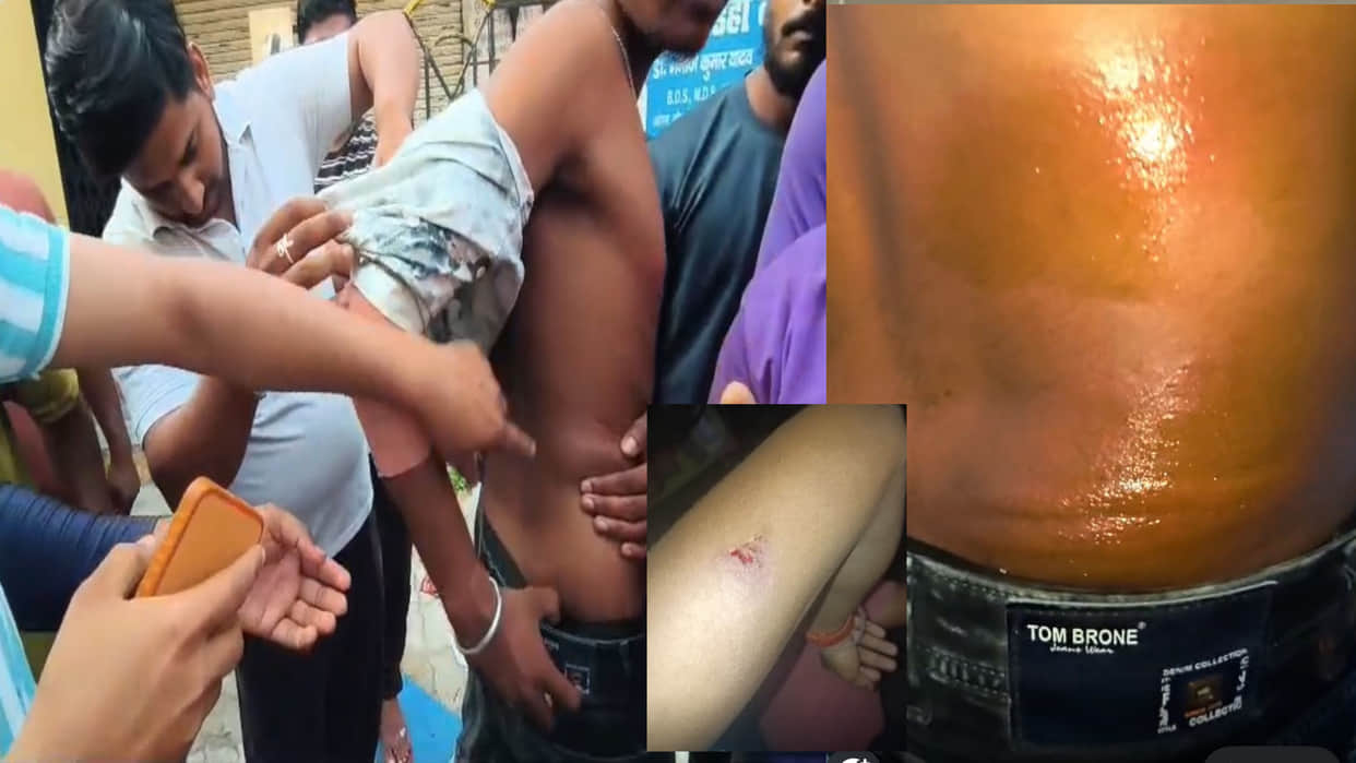 Delivery Boy Beaten After Lights Are Switched Off at Khorabar Police Station in Gorakhpur