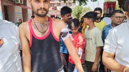 Street dog bites 36 people at bride farewell party in Budaun