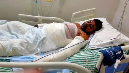 Second Youth Dies in Blast at Jindal Rolling Mill in Hisar; Succumbs During Treatment Deceased Hailed from UP