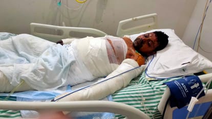 Second Youth Dies in Blast at Jindal Rolling Mill in Hisar; Succumbs During Treatment Deceased Hailed from UP