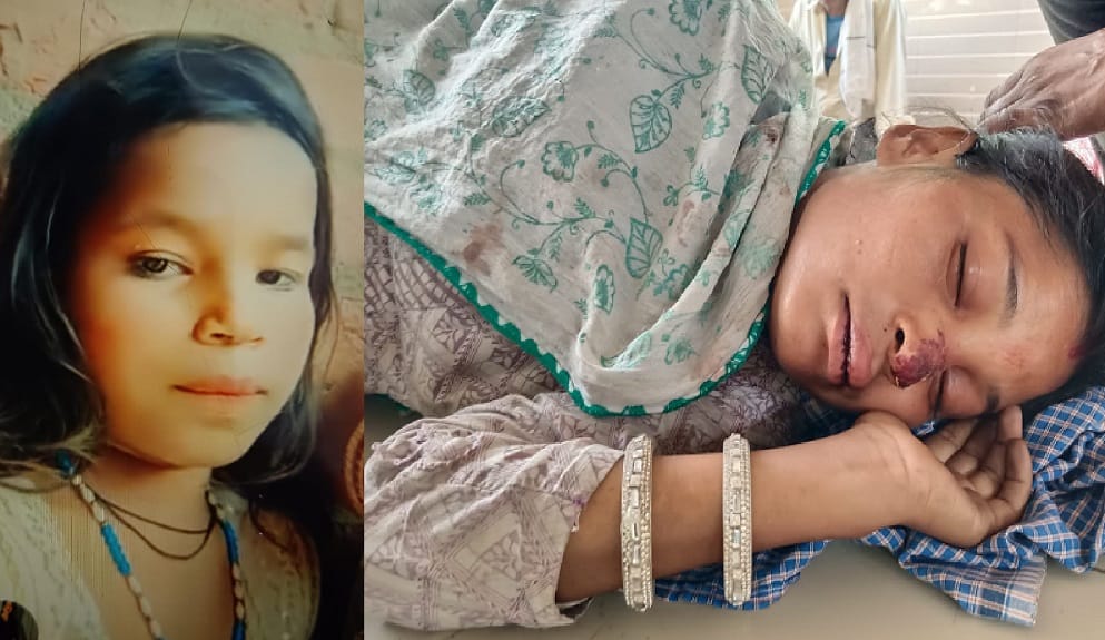 Kanpur Accident Uncontrollable Loader Runs Over Mother and Daughter Child Dies Injured Admitted to Hallett