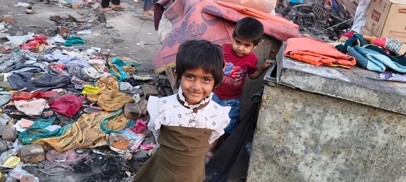 Lucknow: Childhood burnt to ashes in a fire, dreams still alive, innocent girl said- I will study