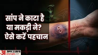 snake bite vs spider bite mark differences symptoms how to identify