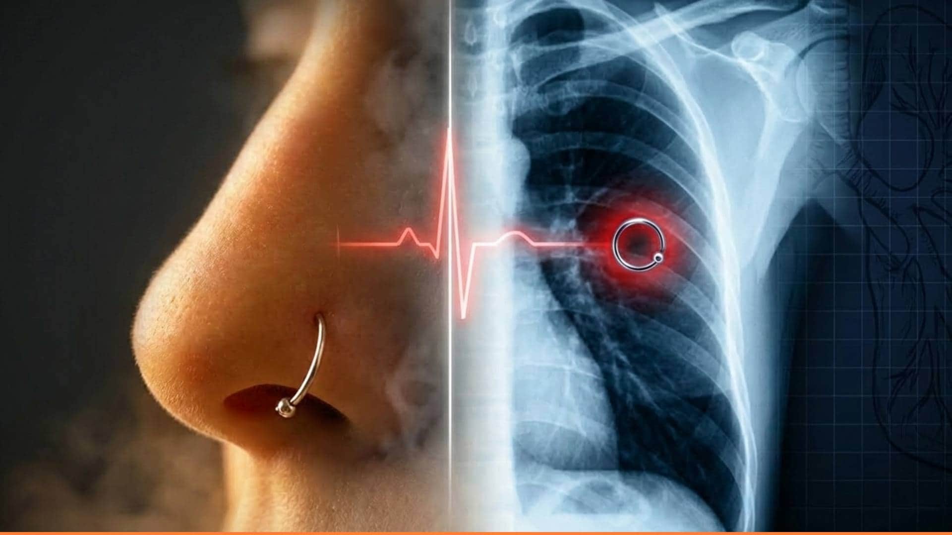 Mexican woman discovers lost nose ring lodged in her lung after month of chronic coughing