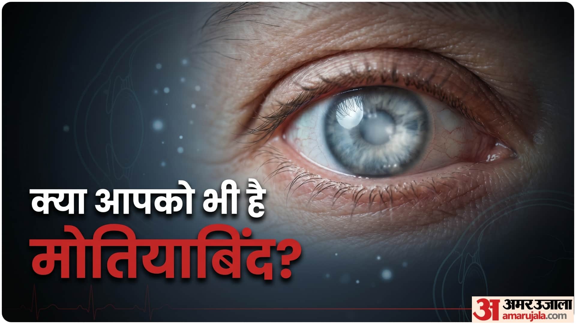 cataract causes and symptoms and treatment cataract surgery in summer safe or not