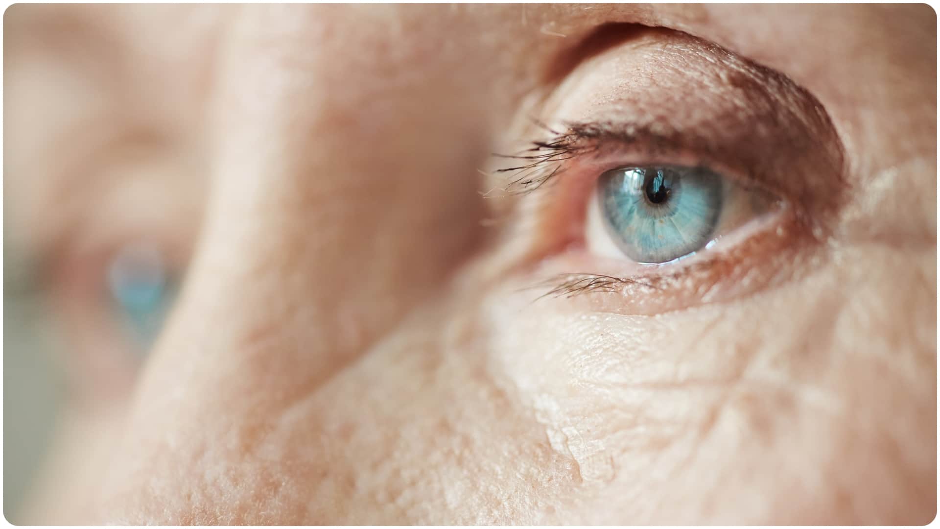 cataract causes and symptoms and treatment cataract surgery in summer safe or not