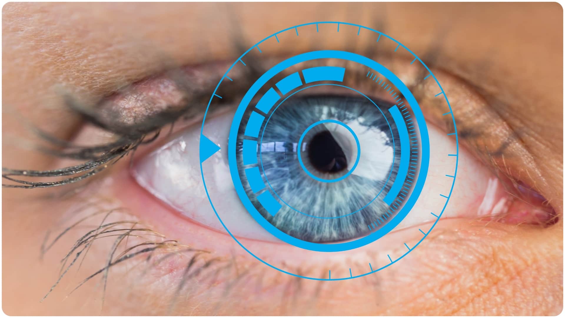 cataract causes and symptoms and treatment cataract surgery in summer safe or not