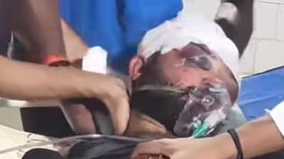 second criminal who robbed jewellery shop in Gopalganj also died in Patna after being beaten by villagers