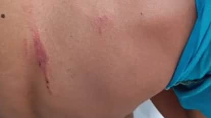 Man Locks Three Children Inside Shop and Beats Them with a Belt for Picking Mulberries in Bareilly