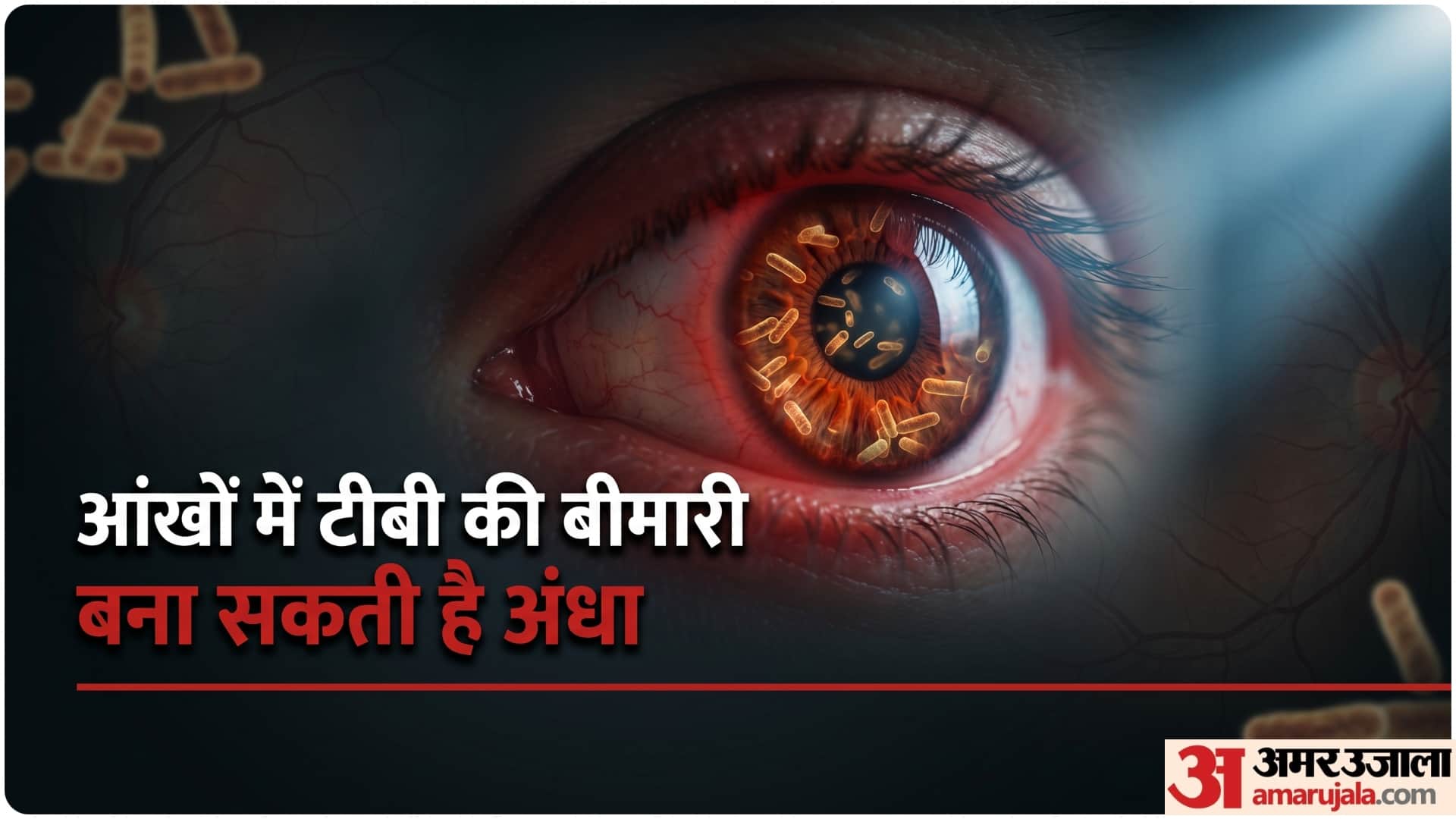 tuberculosis tb risk factors eye tuberculosis symptoms causes and treatment