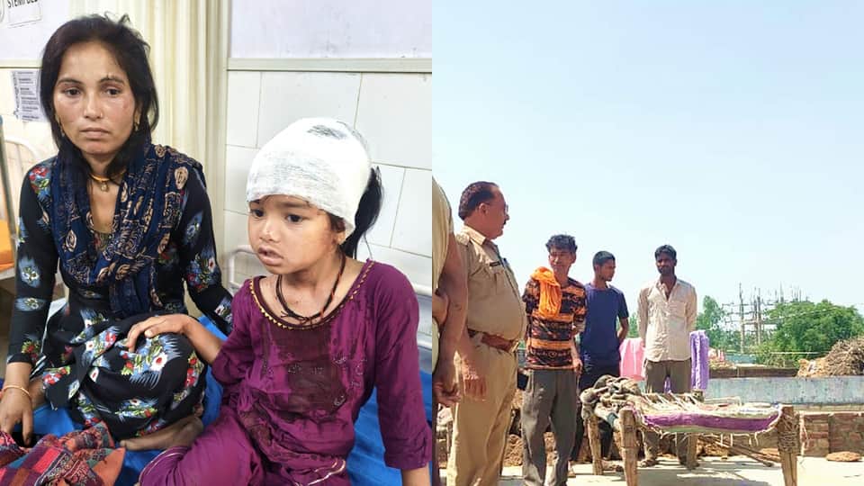 तेंदुए के हमले में जख्मी बच्ची। घटना के बाद जांच करती वन विभाग की टीम