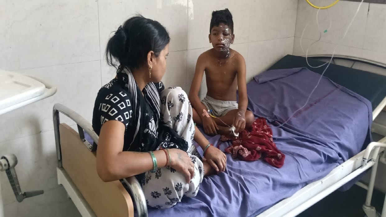 Three children in Panipat suffer burns after coming into contact with electric current