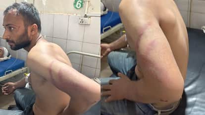 Instagram Friendship Turns Violent Youth Beaten In Agra Village