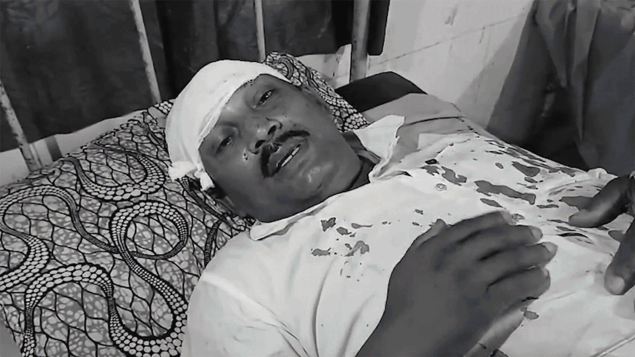 Violence erupts during voting, BJP candidate's vehicle attacked; TMC and ISF supporters also clash
