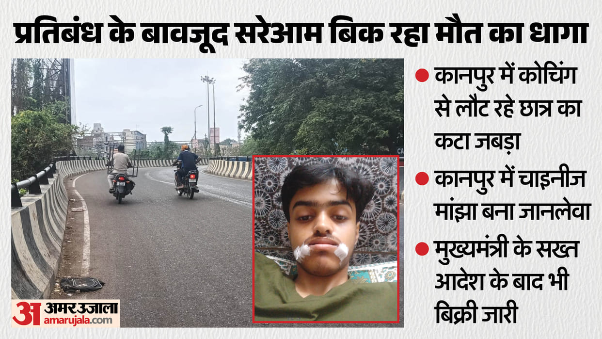 Chinese Manja Injures Class 11 Student in Kanpur Jaw Severely Cut Near Khapra Mohal