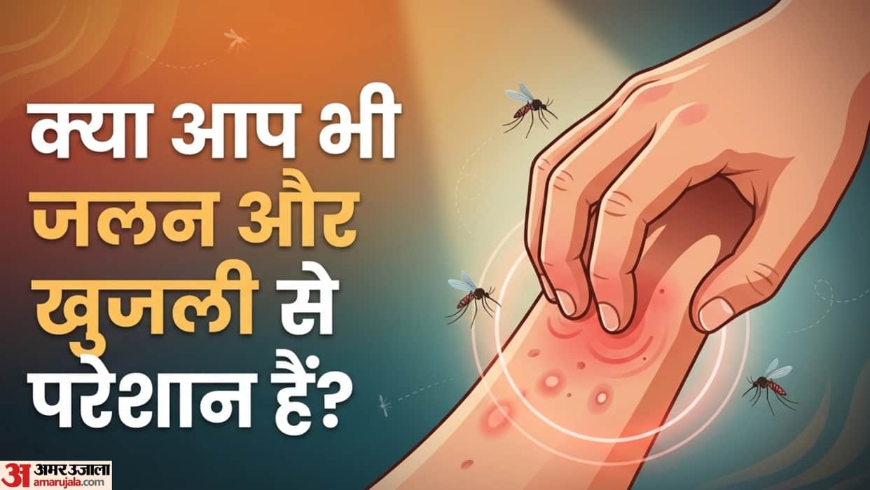 home remedy for mosquito bite itching machhar katne par kya lagaen