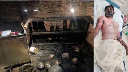 In Basti, a girlfriend locked her boyfriend in a room and set him on fire, they were living together.
