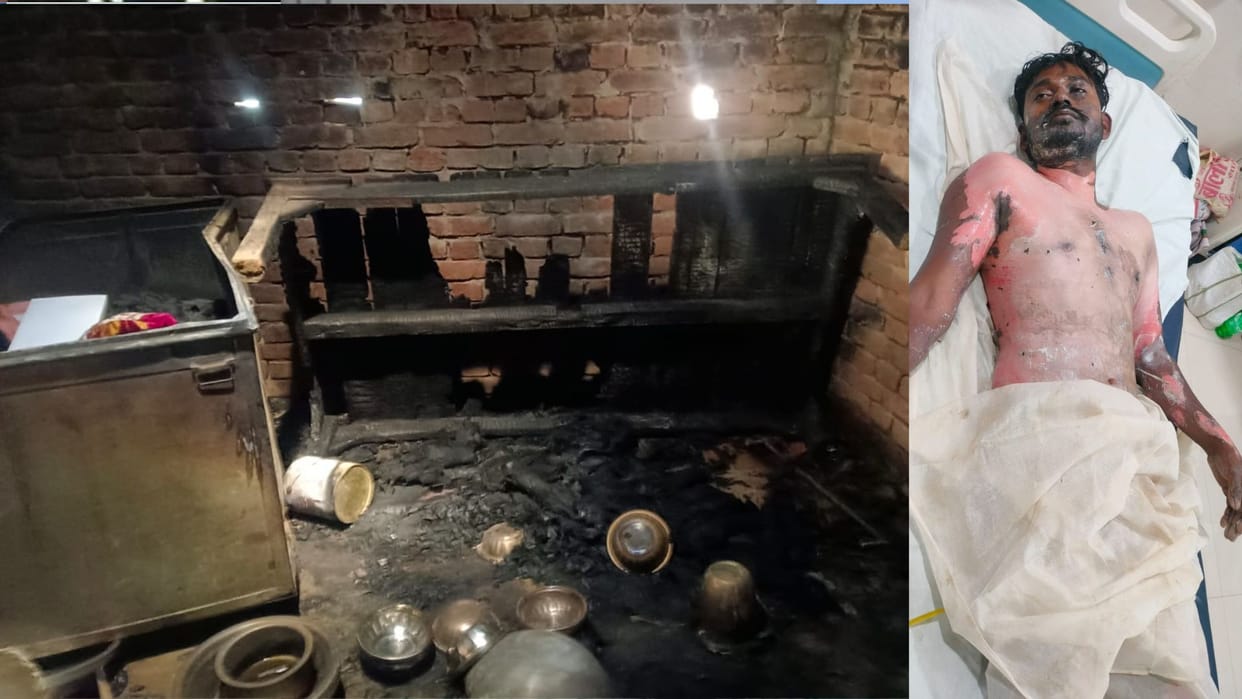 In Basti, a girlfriend locked her boyfriend in a room and set him on fire, they were living together.
