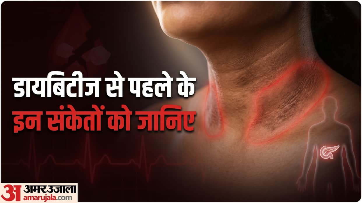 dark velvety patches on the skin linked to prediabetes know diabetes ki kya pahchan hai