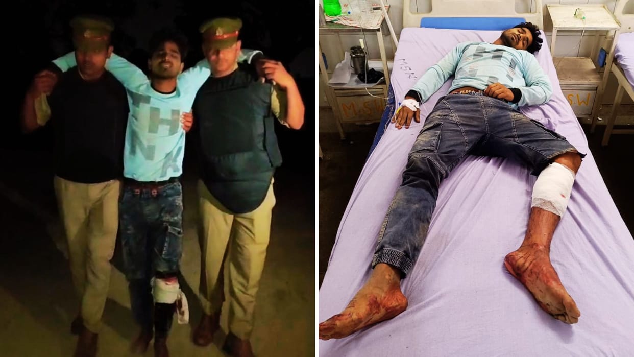 Encounter in Azamgarh Cattle Slaughterer Injured Arrested Fleeing After Firing Police