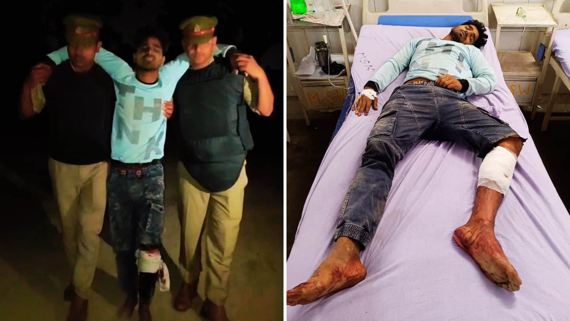 घायल बदमाश को पुलिस ने अस्पताल में कराया भर्ती।