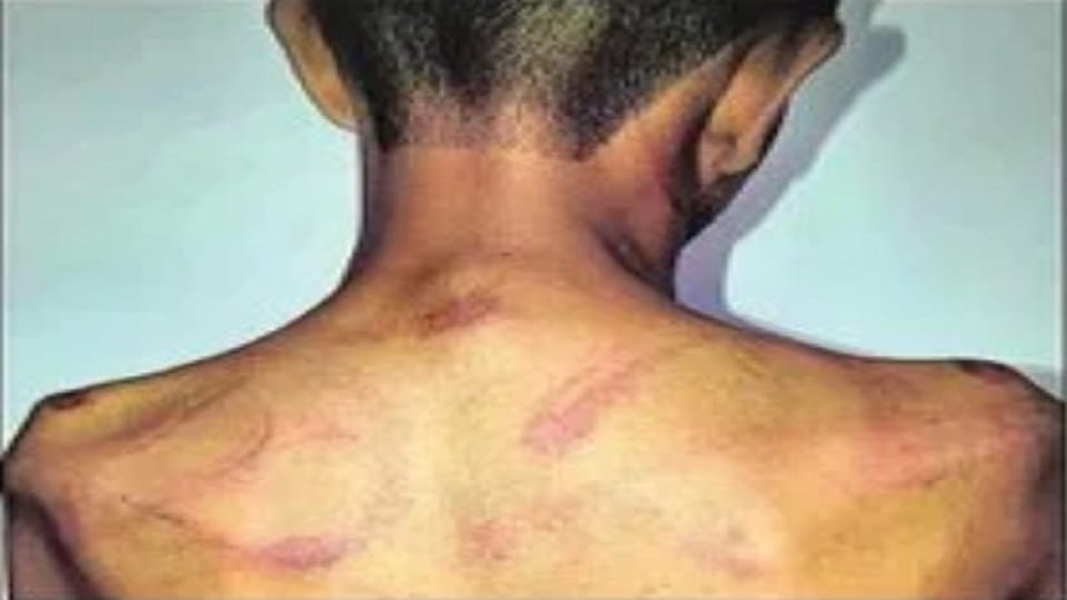 Noida: Locked in PG room, teenager beaten with stick
