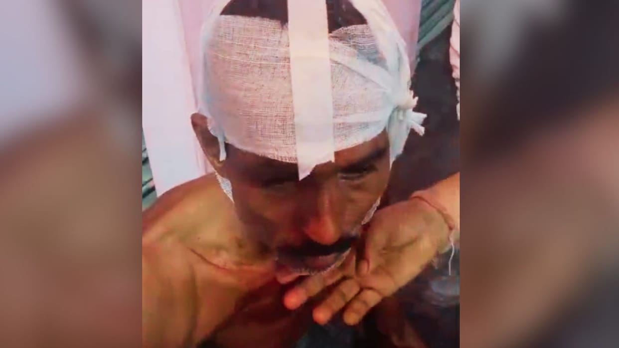 Physical Altercation Over Love Affair Two Rounds Fired Villagers Apprehend Beat Accused