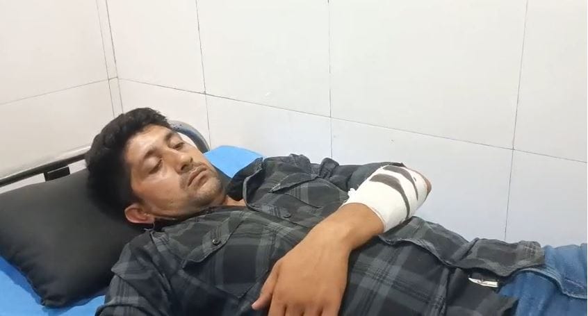 Earring Snatchers Held in Encounter Shot in Legs Constable Injured