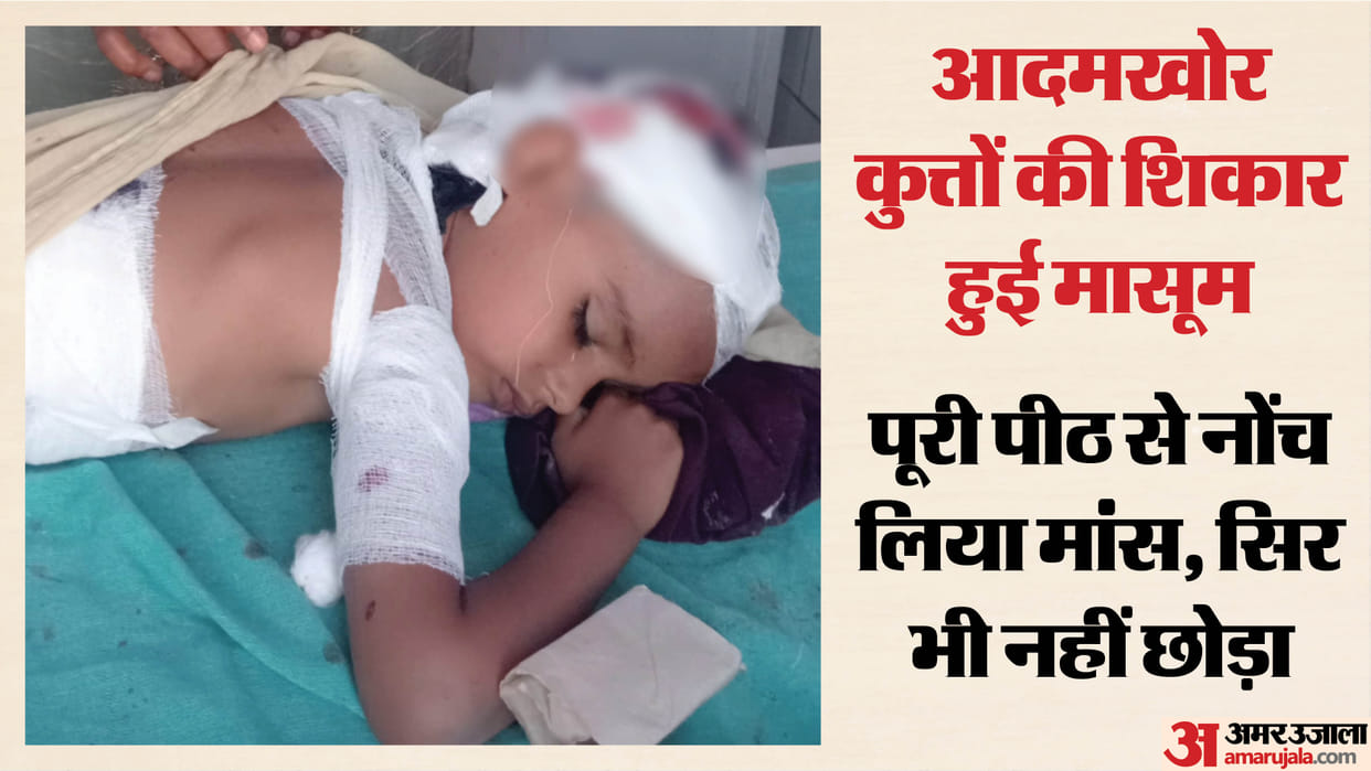 four-year-old innocent child attacked by dogs in Moradabad