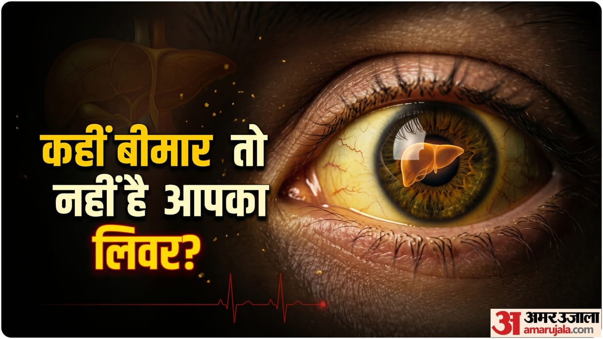 liver disease signs in eyes jaundice cause liver problems how to identify