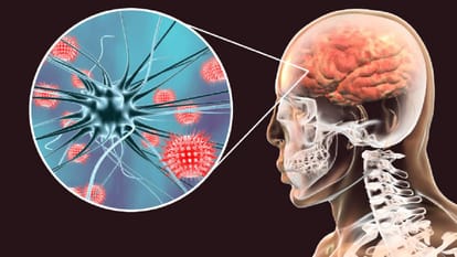 UP: Major Victory Against Encephalitis—Not a Single Death Reported This Year; Gorakhpur's Method Proves to be