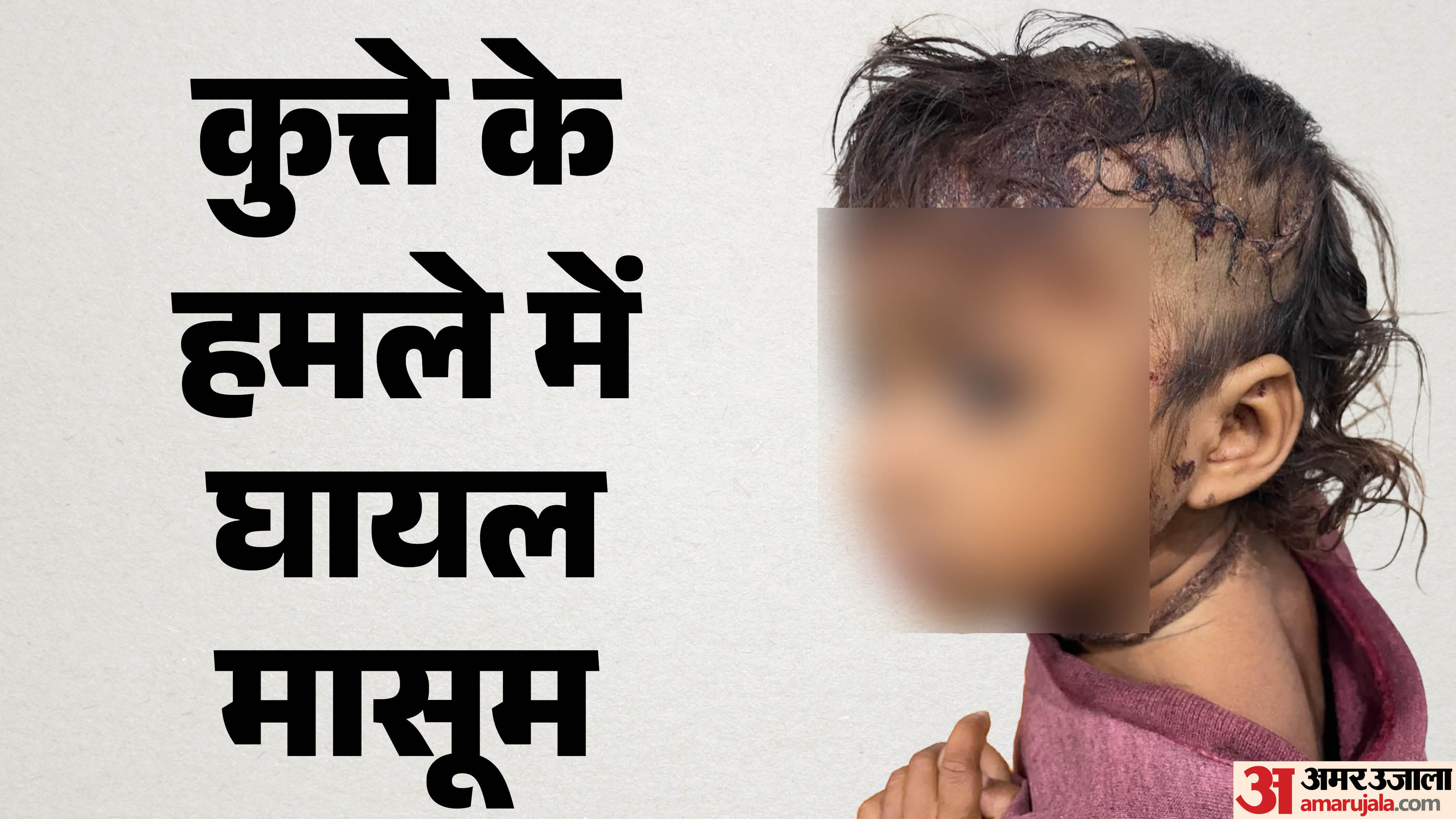 घायल मासूम