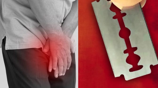 Hardoi Girlfriend brutally attacks young man severs his private parts with a blade referred to medical college
