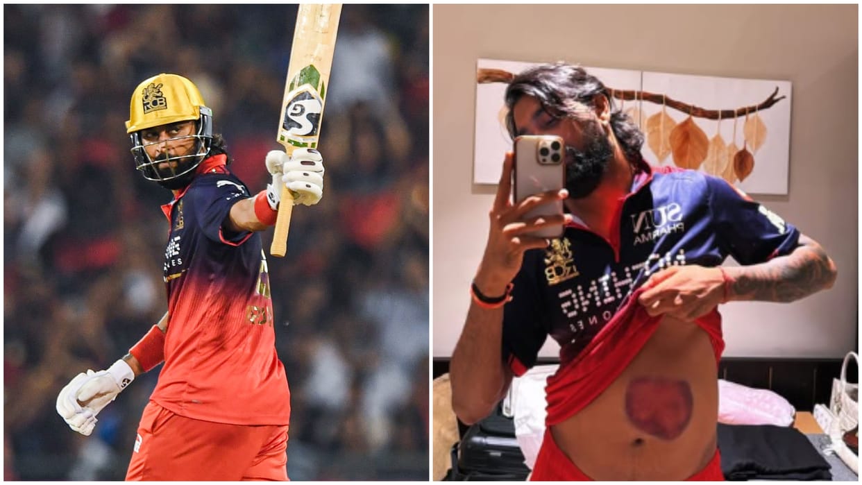 IPL 2026 RCB vs MI: Krunal Pandya shared photo of injury on stomach see