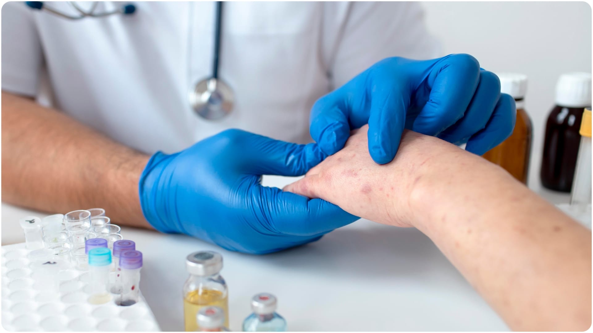 what is lupus disease and what are the symptoms skin rashes and joint pain causes