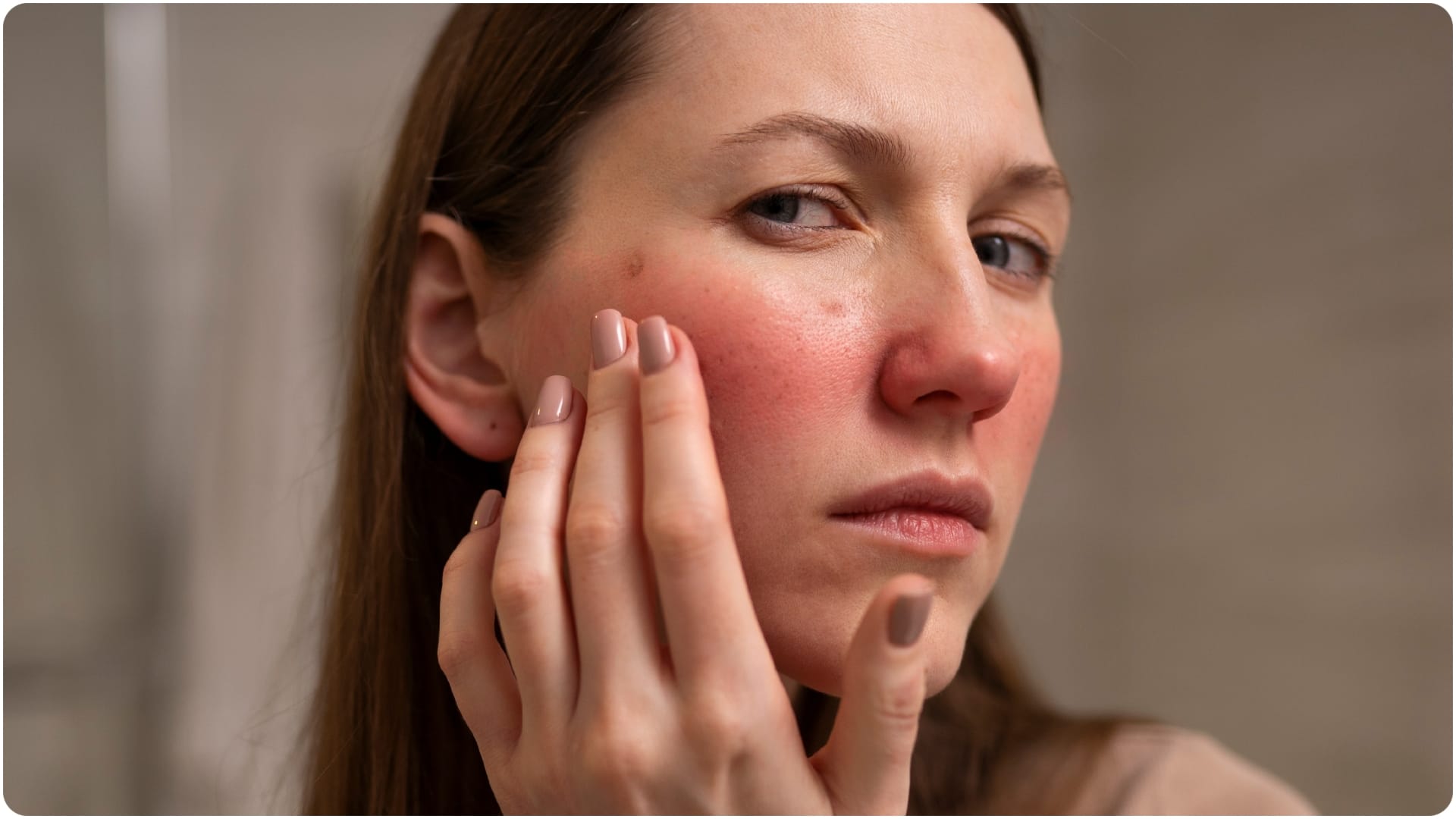 what is lupus disease and what are the symptoms skin rashes and joint pain causes