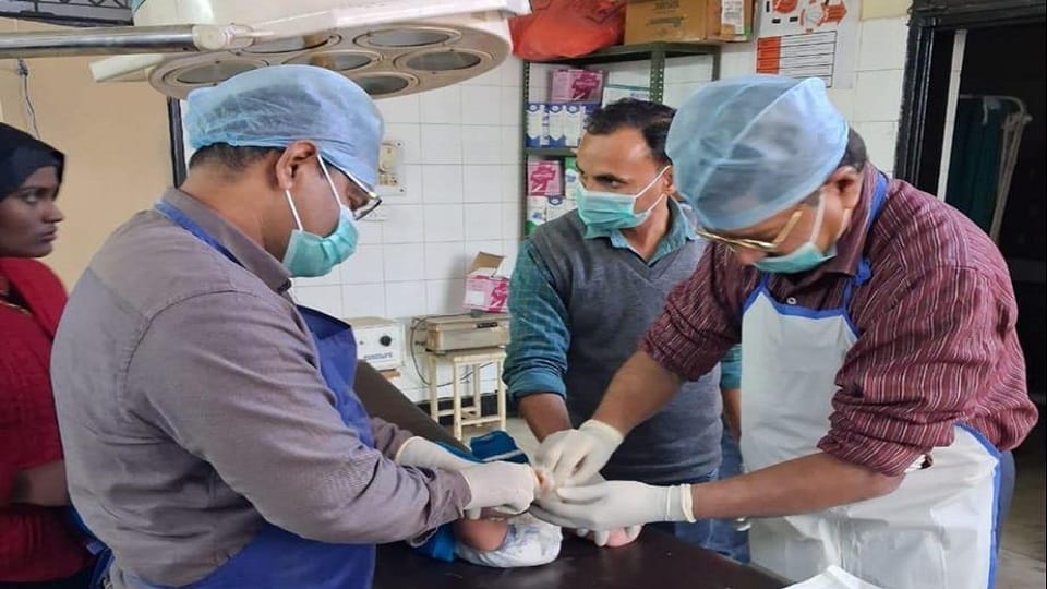 clubfoot problem in children