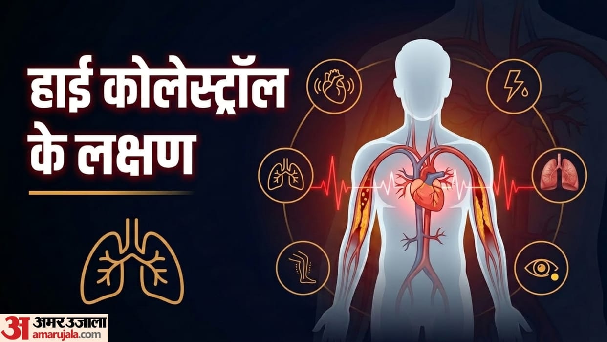 High cholesterol Symptoms and causes Signs of Increase Cholesterol in the Body disprj
