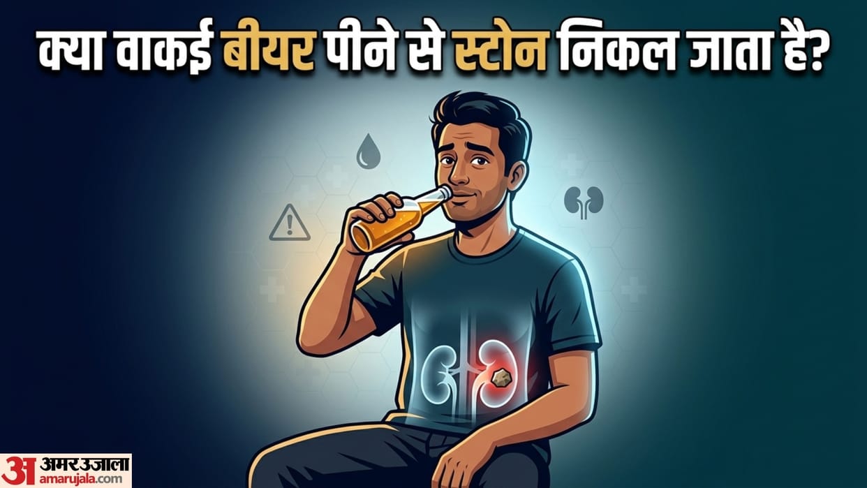 kidney stone treatment kya beer pine se kidney stone nikal jata hai