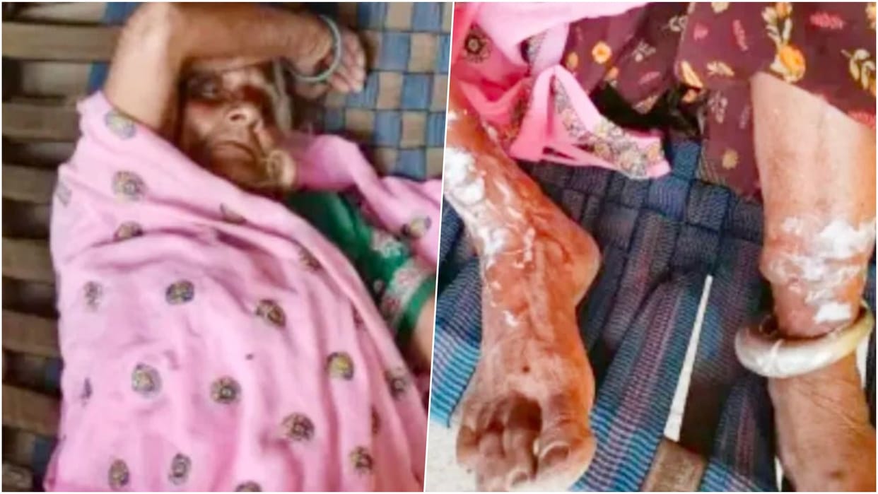 Dausa News: Miscreants Entered Home on Pretext of Asking for Water, Cut Silver Anklets With Grinder Machine