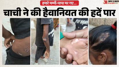 Aunt Burns Innocent Child with Heater In Kanpur police found injuries on bodies of four siblings