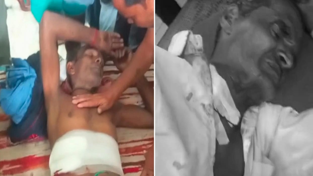 Leopard Attacks People Sitting Outside Homes, Four Villagers Injured