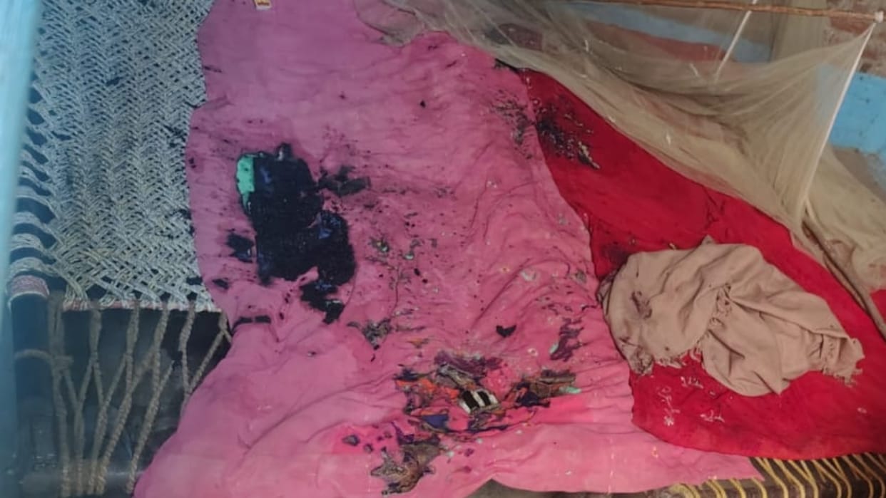 Acid attack on family sleeping at home in Bareilly