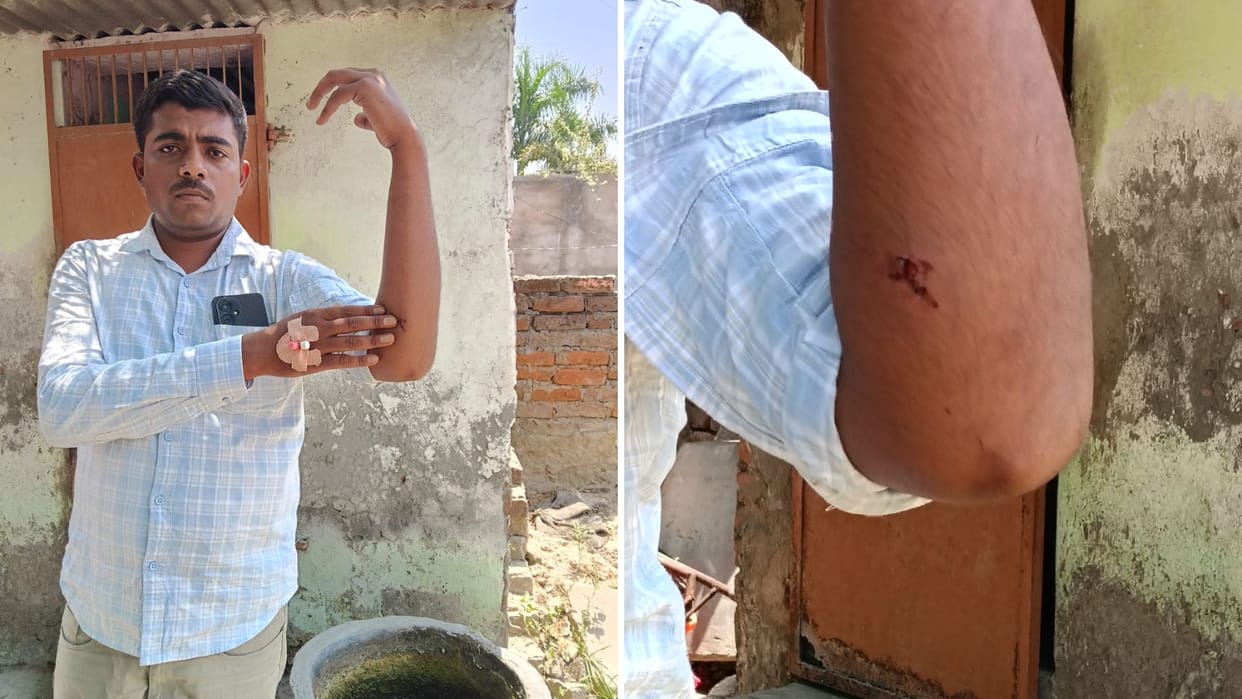 Varanasi News Youth Shot During Dispute Over Pass Assailants Flee Towards Prayagraj Police Register FIR