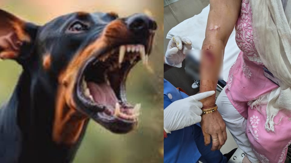 Dehradun: Rottweiler Dog attacks teacher who arrived at home for census duty; suffers deep wounds on her arm