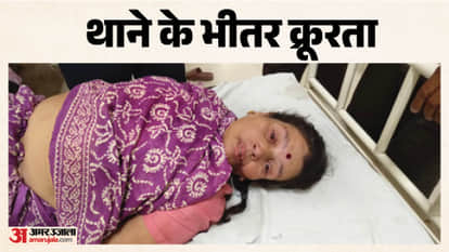 ujjain kotwali police station elderly woman assault allegation news