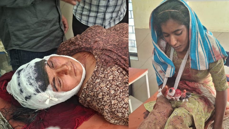 Shamli: Sister and her 20-day-old baby attacked with stake, woman and girl who came to rescue also injured